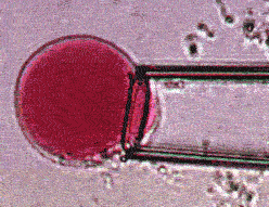 Aspiration of a vacuole in a micropipette