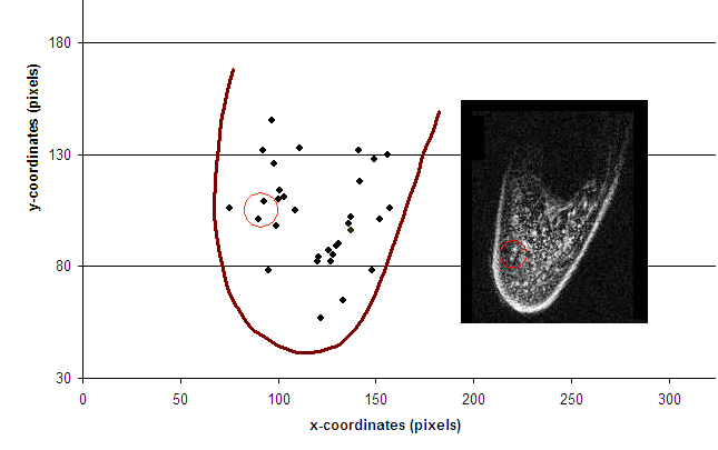 MRI scan of fingertip