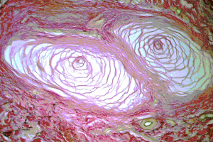 Histological section of a pacinian corpuscle